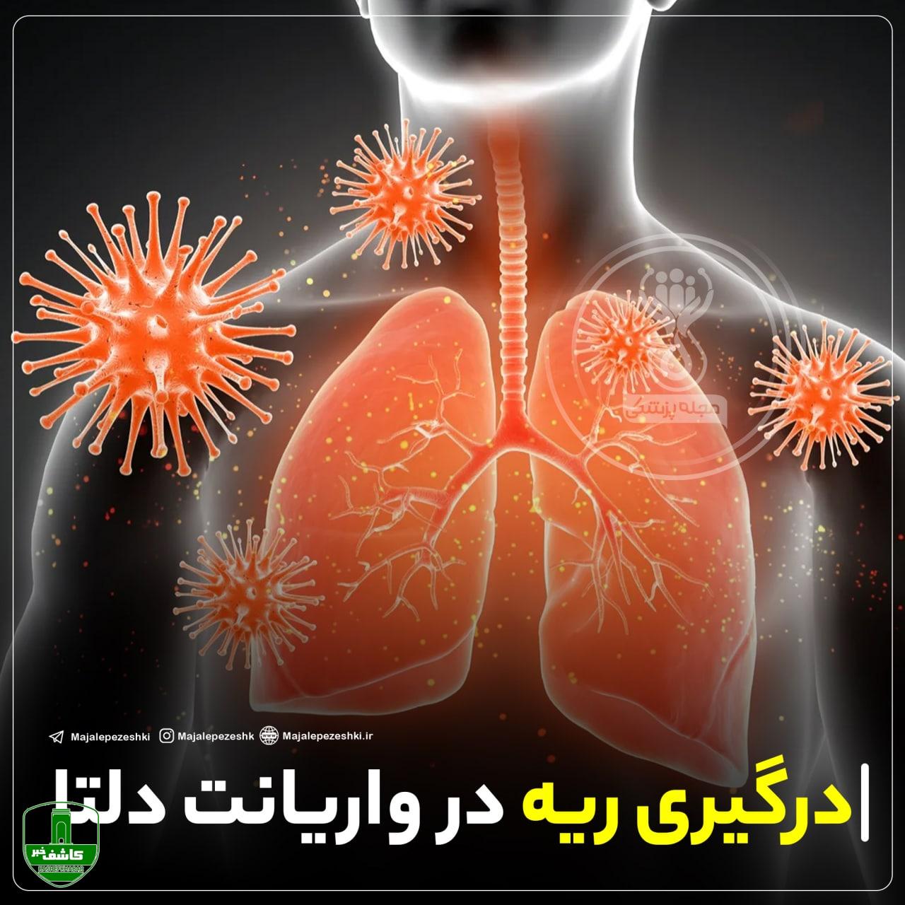 درگیری ریه در واریانت دلتا به چه صورت است ؟