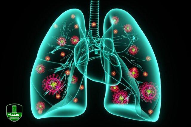 احتمال تاثیر کرونا در بروز ذاتالریه/ مصرف خودسرانه آنتیبیوتیکها؛ ممنوع