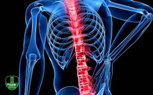 شایعترین علائم سیاتیک/ روش هایی که برای درمان باید یاد گرفت
