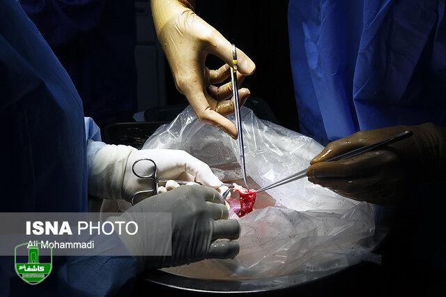 ۲۵ هزار نفر در لیست پیوند عضو در کشور/ سالی ۷۰۰۰ عضو سالم زیر خاک میرود