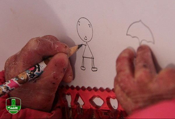 شناسایی ۴۲۲ بیماری نادر در ایران/پوشش ویژه ۳۱۷ بیماری در «صندوق خاص و صعبالعلاج» شناسایی ۴۲۲ بیماری نادر در ایران/پوشش ویژه ۳۱۷ بیماری در «صندوق خاص و صعبالعلاج»