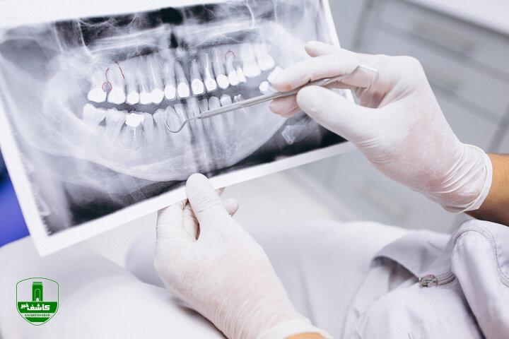 اقتصاد مردم دچار چالش‌ جدی است؛ «مردم به دندان‌پزشک مراجعه نمی‌کنند مگر مجبور شوند»/ بهترین راه جلوگیری از پوسیدگی و خرابی دندان‌ها
