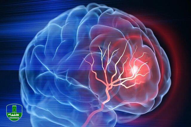 ابتلای هر ۷ دقیقه یک نفر به آلزایمر در کشور/ مهمترین نشانههای بروز این بیماری