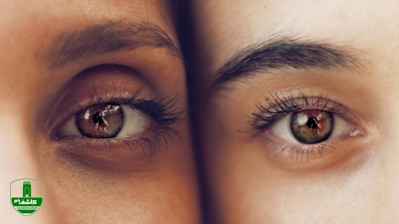 چرا انسانها هرگز چشمان سیاه رنگ ندارند؟ چرا انسانها هرگز چشمان سیاه رنگ ندارند؟