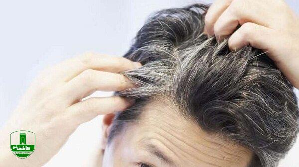 ویتامینی که مصرف آن از ریزش مو جلوگیری میکند