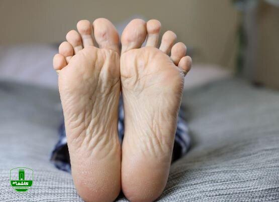چگونه در گرما از پاها مراقبت کنیم؟ چگونه در گرما از پاها مراقبت کنیم؟