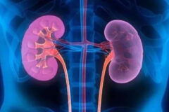 مشروبات الکلی سنگ کلیه را درمان میکند؟