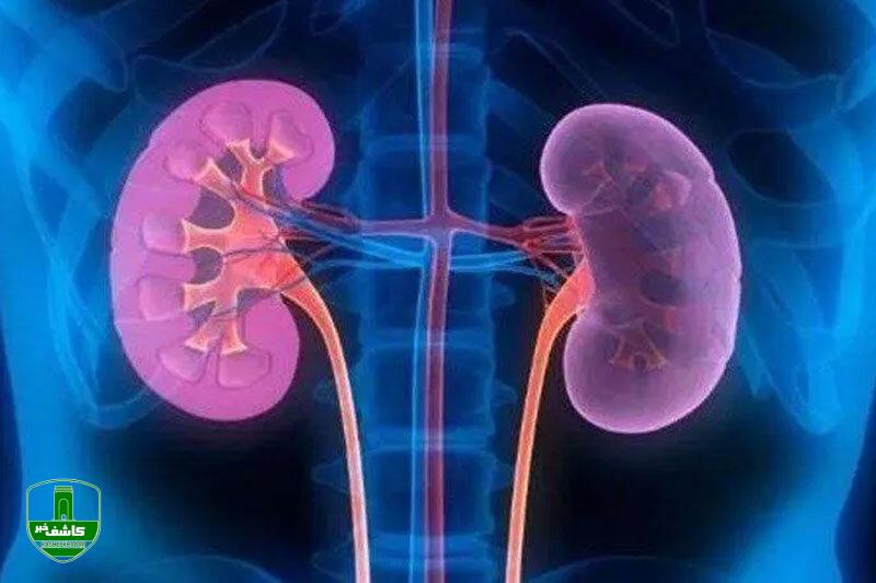 مشروبات الکلی سنگ کلیه را درمان میکند؟